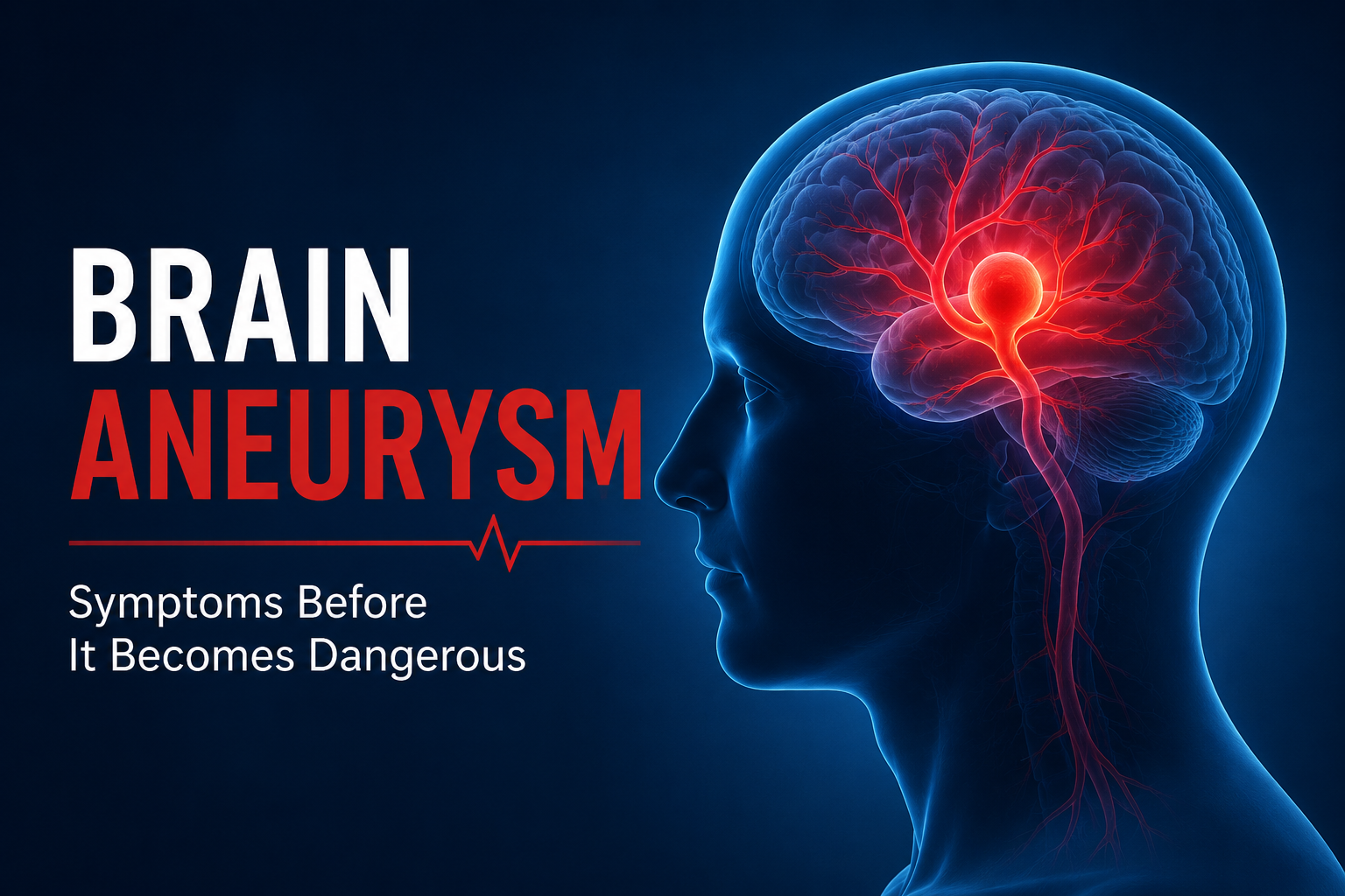 Brain Aneurysm