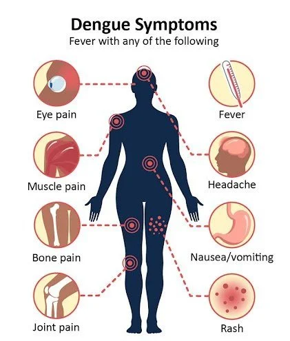 Dengue