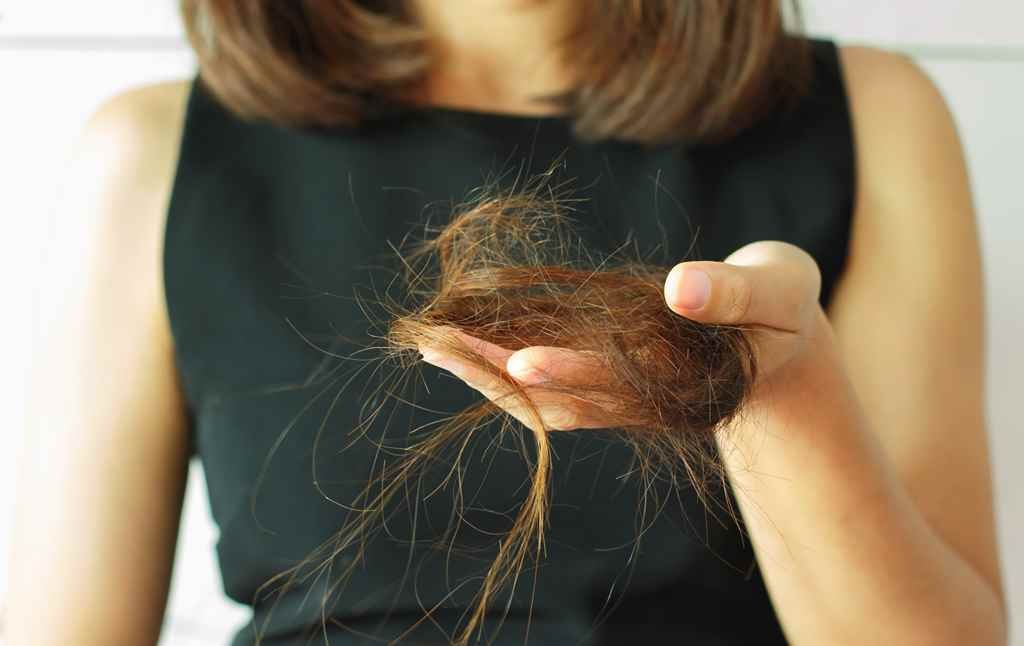 Hair Loss