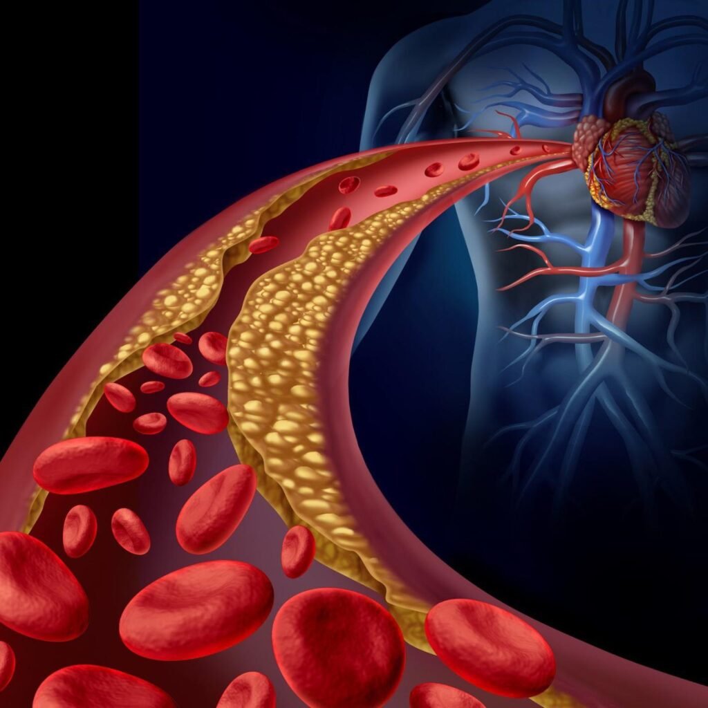 Cholesterol