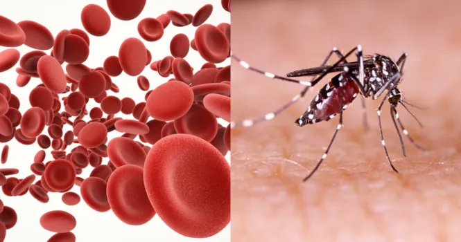 Dengue